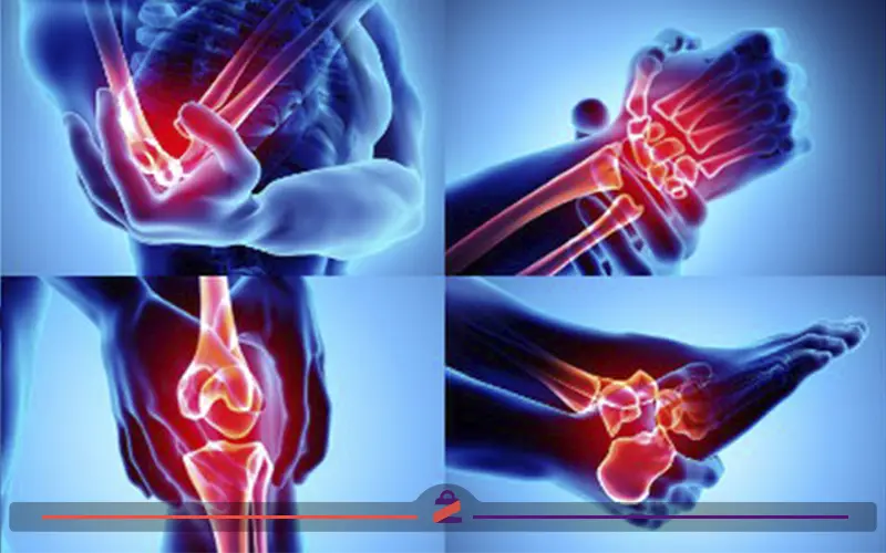 تصویری ازرادیولوژی آتروز زانو 