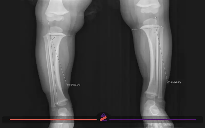 رادیولوژی پای پرانتزی