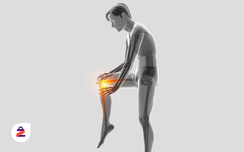 آرتروز زانو باعث کم شدن تحرک افراد میشود