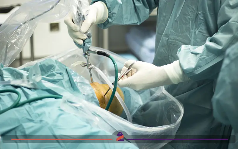 جراحی برای درمان نرمی غضروف کشکک زانو