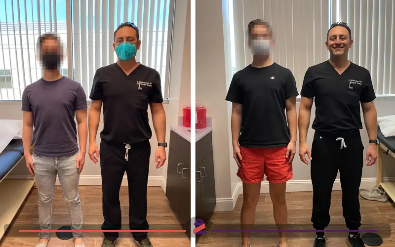 نمونه کار جراحی افزایش قد