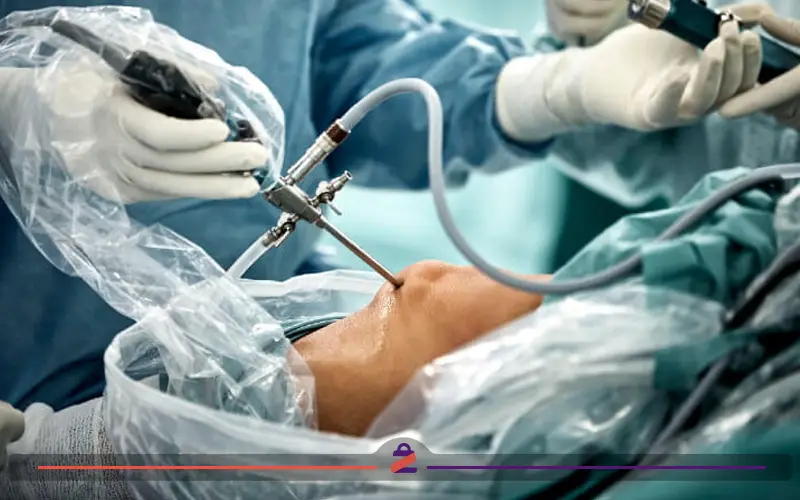 جراحی آتروسکوپی زانو