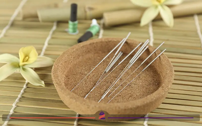 سوزن های طب سوزنی برای درمان زانو